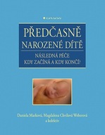 Předčasně narozené dítě - Následná péče - kdy začíná a kdy končí? Daniela