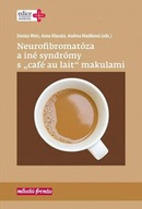 Neurofibromatóza a iné syndromy s „café au lait" makulami Anna