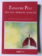 Zapalenie płuc Aktualne problemy kliniczne Płusa