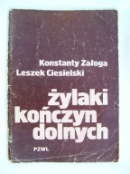 Żylaki kończyn dolnych K.Załoga L.Ciesielski