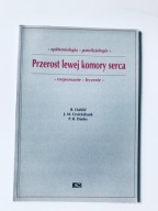 Przerost lewej komory serca rozpoznanie Dahlof