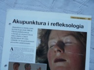 SAMOLECZENIE AKUPUNKTURA I REFLEKSOLOGIA