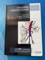 Żylna choroba zakrzepowo-zatorowa. T.Zubilewicz, P.Terlecki