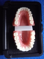 Model szczęki z aparatem ORMCO