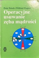 Operacyjne usuwanie zęba mądrości - Peter Testch, Wilfried Wagner