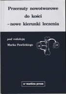 Przerzuty nowotworowe do kości Nowe kierunki leczenia Pawlicki Marek