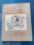 Atlas of Laparoscopic Colon Surgery