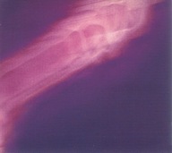 This Heat – Repeat CD