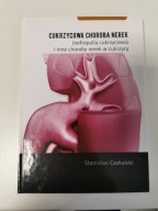 Cukrzycowa choroba nerek Stanisław Czekalski