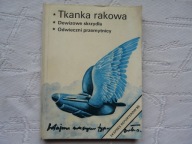EKSPRES REPORTERÓW 85 Tkanka rakowa Dewizowe skrzydła, Odwieczni przemytnic