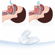 Nakładka na zęby przeciw chrapaniu