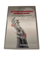 Niebrzydowski - Jak leczyć reumatoidalne zapalenie stawów