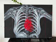 "Anatomia splotu" - obraz 100x70 cm, technika mieszana