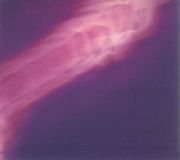 This Heat – Repeat