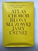 Atlas chorób błony śluzowej jamy ustnej Tadeusz Owiński Barbara Owińska