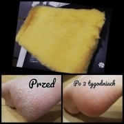 Rękawica do peelingu ciała Raypath 