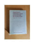 Zakrzepy i powikłania zatorowe w chirurgii Witold Rudowski