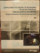Zapalenie pochewki ścięgnowej i ścięgna mięśnia dwugłowego ramienia
