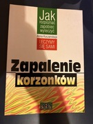 Zapalenie korzonków. Anna Kuczanskaja