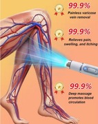 Laser niebieskie światło do terapi żylaki pajączki + maść niwelująca
