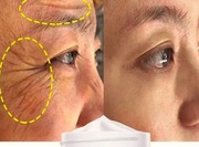 Krem przeciw zmarszczkowy z Retinolem 30g