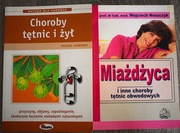 Miażdżyca ,choroby żył i tętnic- przyczyny ,objawy, leczenie i zapobieganie