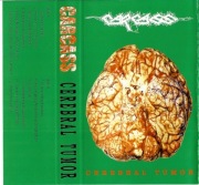 Carcass Cerebral Tumor MC live '90 Dead Infection Disgorge Defecation Dead