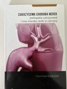 Cukrzycowa choroba Nerek nefropatia cukrzycowa Czekalski