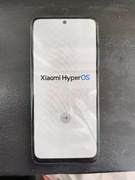 Xiaomi Redmi Note 11