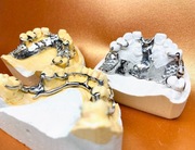 Proteza szkieletowa. Podwykonawstwo