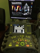 Aparat Ultrasonograficzny Toshiba Aplio SSA 700A