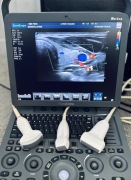 Ultrasonograf/ USG/ SonoScape S8Exp/ Elastografia/ 3x głowice