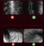 Nowy Masażer elektryczny szczotka do skóry głowy+olejek gratis do wyboru