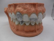 ZABYTKOWE MODELE LUDZKICH SZCZĘK Z ZĘBAMI FANTOM