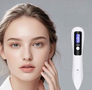 Laser plazmowy do usuwania znamion