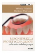 Rekonstrukcja protetyczna zębów po leczeniu endodontycznym Elamed