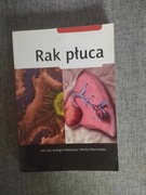 Jerzy Kołodziej, Marek Marciniak- Rak Płuca