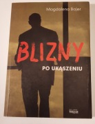 BAJER M./BLIZNY PO UKĄSZENIU