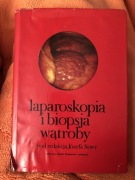 Laparoskopia i biopsja wątroby pod red.Józefa Sowy