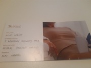 Voucher podarunkowy na laserową depilację pach