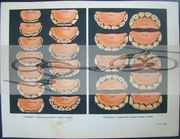 Konie. Rozpoznawanie wieku po uzębieniu.