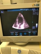 USG Echokardiograf /UKG/ Vivid 3