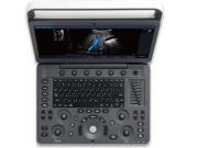 Aparat USG Sonoscape E2