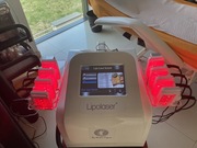 Lipolaser odchudzanie zimnym laserem