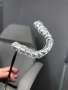 Indywidualna szyna relaksacyjna na bruksizm