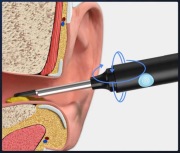Smart Otoskop WiFi z Kamerą HD 3mm – Profesjonalne Czyszczenie Uszu w Domu