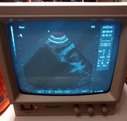 Ultrasonograf ECHO SON ts 1000 exd       (150)