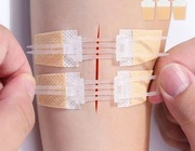 Plastry do zamykania ran, bez szwów, gojenie 8x1,5 cm x2