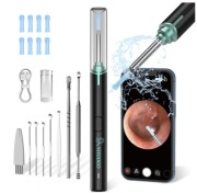 VITCOCO Otoskop Do Usuwania Woskowiny Z Kamerą LED Dla iPhone i Android