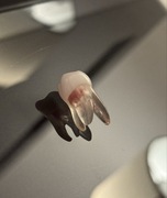 Zęby endodontyczne DRSK - 2634-301-RCW, górny pierwszy trzonowiec